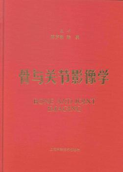 感染性疾病 PDF下载 免费 电子书下载