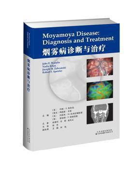烟雾病诊断与治疗 PDF下载 免费 电子书下载